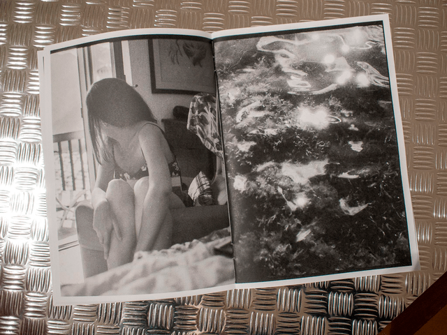 18274 (days of life)